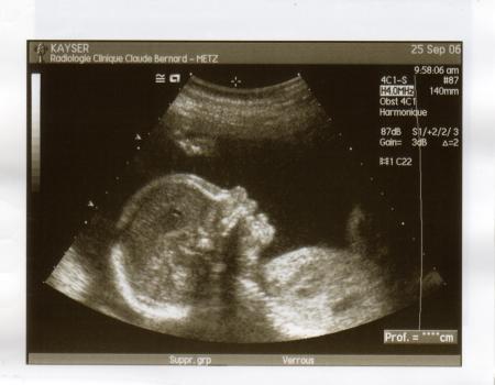 �cho du 5�me mois