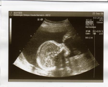 �cho du 5�me mois