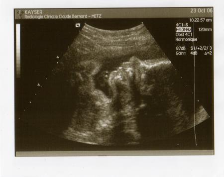 �cho fin 6� mois